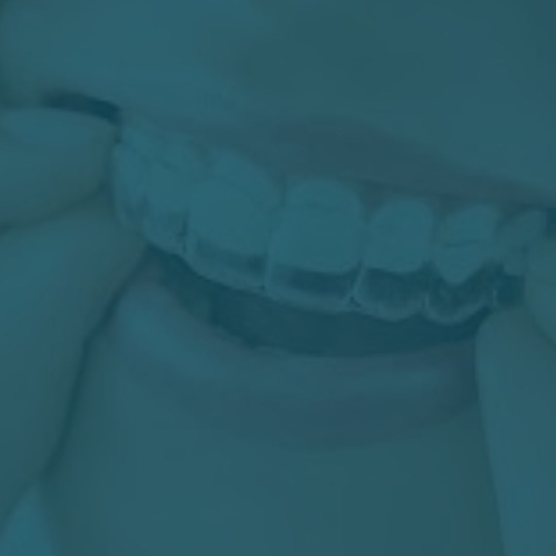 Oral Appliances